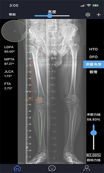 华保膝望手机客户端下载