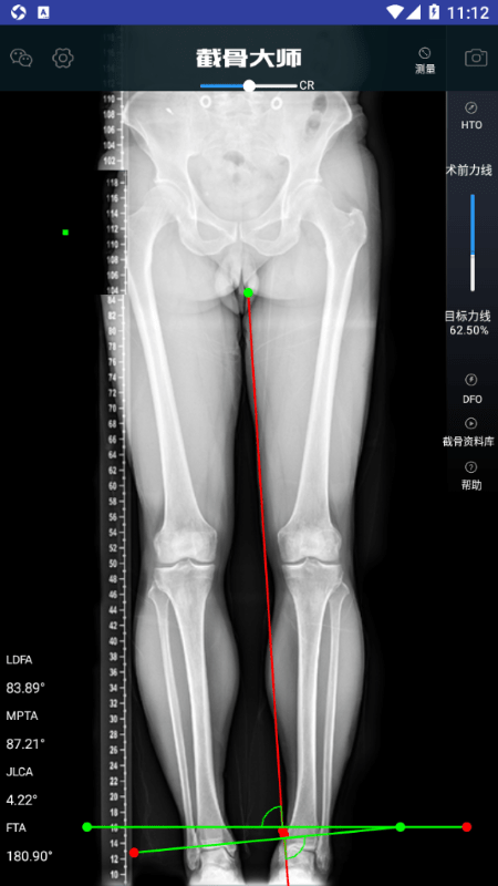 截骨大师软件下载